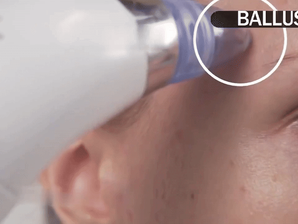 Pore Cleaning Device